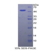 SDS-PAGE analysis of recombinant Human IL21 Protein.