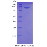 SDS-PAGE analysis of CDK2 Protein.