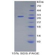 SDS-PAGE analysis of Podocalyxin Protein.