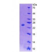 SDS-PAGE analysis of Colony Stimulating Factor 1, Macrophage Protein.