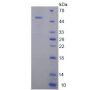 SDS-PAGE analysis of recombinant Mouse Tenascin C Protein.