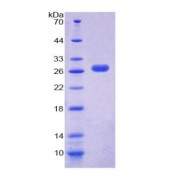 SDS-PAGE analysis of CXCL16 Protein.