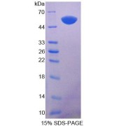 SDS-PAGE analysis of Keratin 14 Protein.