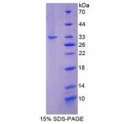 SDS-PAGE analysis of recombinant Mouse N-Acetyltransferase 1 Protein.