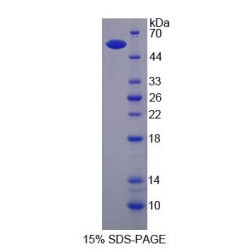 Mouse Integrin Beta 6 (ITGb6) Protein