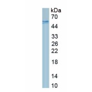 SDS-PAGE analysis of recombinant Integrin Beta 6 Protein.