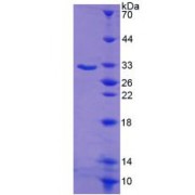 SDS-PAGE analysis of Serum/Glucocorticoid Regulated Kinase 1 Protein.