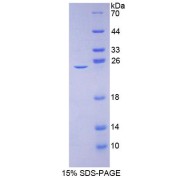 SDS-PAGE analysis of CACNA1C Protein.