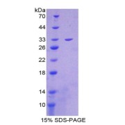 SDS-PAGE analysis of Citrate Synthase Protein.