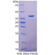 SDS-PAGE analysis of Prothrombin Fragment 1+2 Protein.