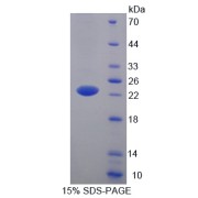 SDS-PAGE analysis of Lipocalin 5 Protein.