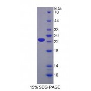SDS-PAGE analysis of CACNA1S Protein.