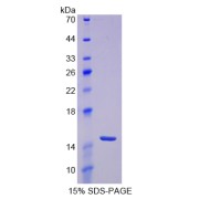 SDS-PAGE analysis of Tumor Necrosis Factor Receptor Superfamily, Member 19 Protein.