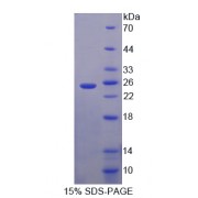 SDS-PAGE analysis of Mouse CITED1 Protein.