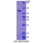 SDS-PAGE analysis of recombinant Mouse Metallothionein 1 Protein.