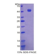 SDS-PAGE analysis of IL21 Protein.