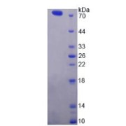 SDS-PAGE analysis of ATPase, Ca++ Transporting, Plasma Membrane 2 Protein.