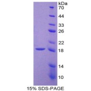 SDS-PAGE analysis of TNFSF11 Protein.