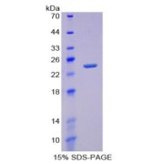 SDS-PAGE analysis of Receptor Activator Of Nuclear Factor kappa B Protein.