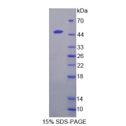 SDS-PAGE analysis of Galactose-1-Phosphate Uridylyltransferase Protein.