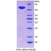 SDS-PAGE analysis of Natriuretic Peptide Receptor 3 Protein.