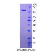 SDS-PAGE analysis of recombinant Rat Glycoprotein IX, Platelet Protein.