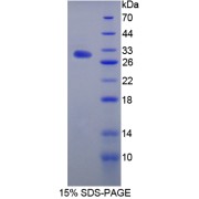 SDS-PAGE analysis of IL17RA Protein.