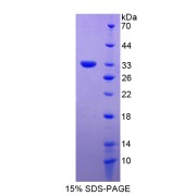 SDS-PAGE analysis of Haptoglobin Protein.