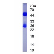 SDS-PAGE analysis of Immunoglobulin G Protein.