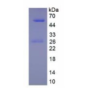 SDS-PAGE analysis of Immunoglobulin G1 Protein.