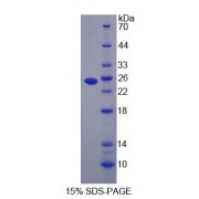 SDS-PAGE analysis of Human LMP2 Protein.