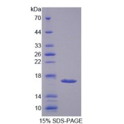 SDS-PAGE analysis of Rat HEXb Protein.