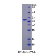 SDS-PAGE analysis of Human TLR4 Protein.