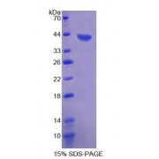 SDS-PAGE analysis of recombinant Human CD9/MRP1 Protein.