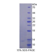 SDS-PAGE analysis of recombinant Human CD81 Protein.