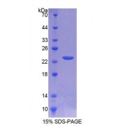 SDS-PAGE analysis of Rat TNFRSF5 Protein.