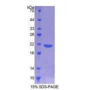 SDS-PAGE analysis of Rat CD164 Protein.