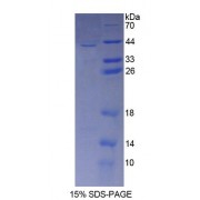 SDS-PAGE analysis of Human CLEC4L Protein.