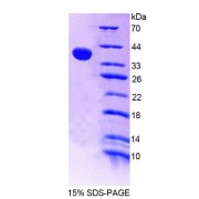 SDS-PAGE analysis of recombinant Mouse RIPK2 Protein.