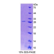 SDS-PAGE analysis of Rat SLAMF2 Protein.