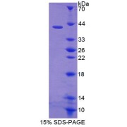 SDS-PAGE analysis of Human EGFR2 Protein.