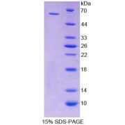 SDS-PAGE analysis of Rat CD19 Protein.