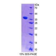 SDS-PAGE analysis of Rat WASP Protein.