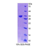 SDS-PAGE analysis of recombinant Human GRIK2 Protein.