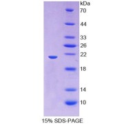 SDS-PAGE analysis of Human HMMR Protein.