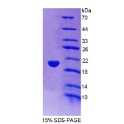 SDS-PAGE analysis of Human TRIM3 Protein.