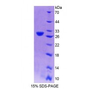 SDS-PAGE analysis of Mouse CENPJ Protein.
