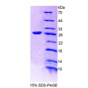 SDS-PAGE analysis of Human ADD1 Protein.