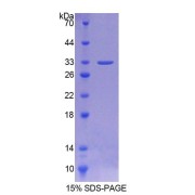 SDS-PAGE analysis of Rat AURKC Protein.