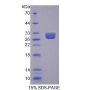 SDS-PAGE analysis of Mouse BCR Protein.